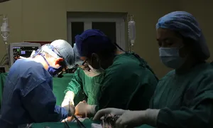 Cắt một phần gan bởi sỏi lấp đầy đường mật